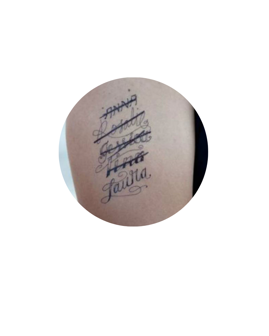 Tattoo-Entfernung